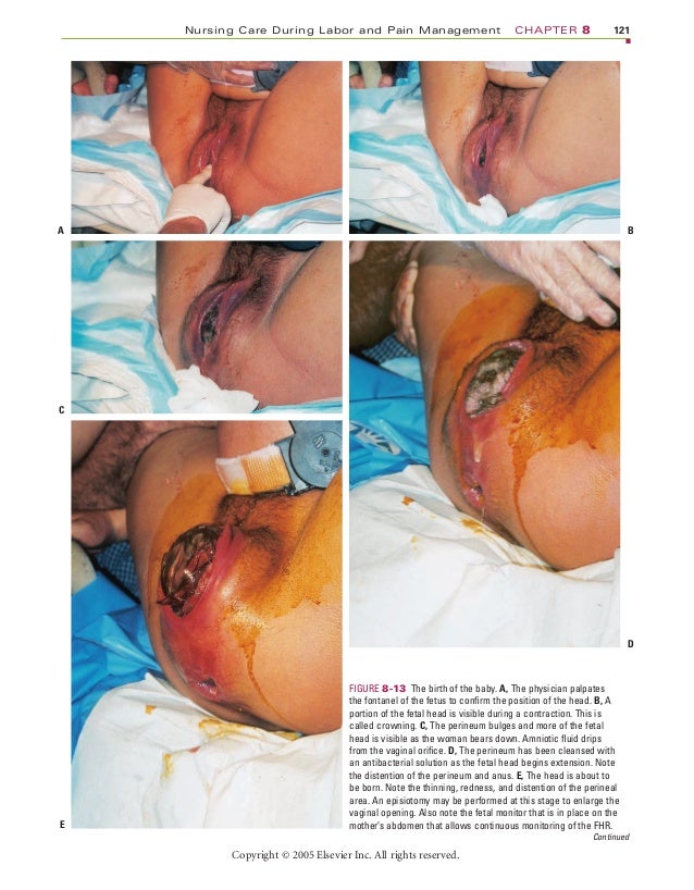 Sex during labor and delivery